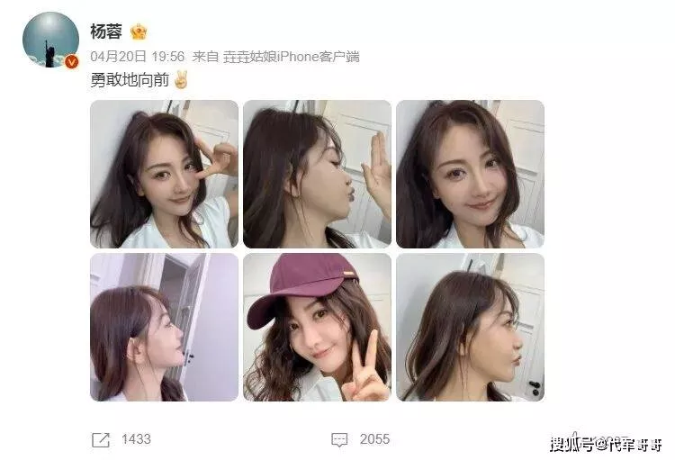 44岁杨蓉近况曝光！晒面部烫伤恢复照片上热搜