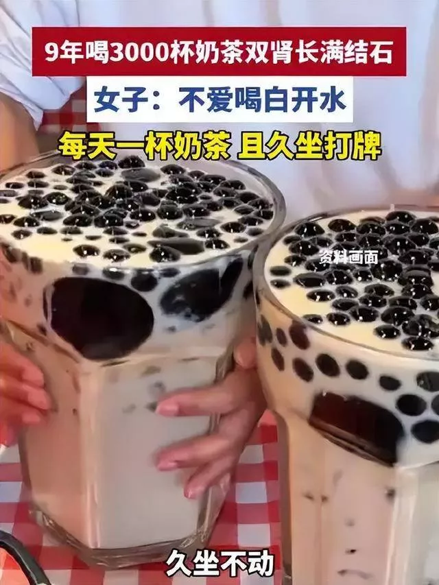 长沙女子9年狂喝3000杯奶茶,肾脏被结石塞满